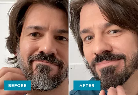 Moustache & Beard Before & After