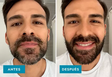 Mustache & Beard Before & After